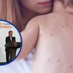 large_caso_de_sarampion_nuevo_leon_colegio_cambridge_secretaria_de_salud_educacion_ebb7c0e54c