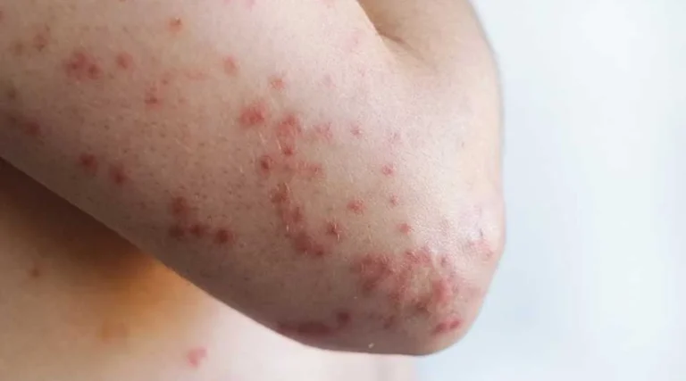 Plecas-e-informacion-2026-02-11T230905.454-1