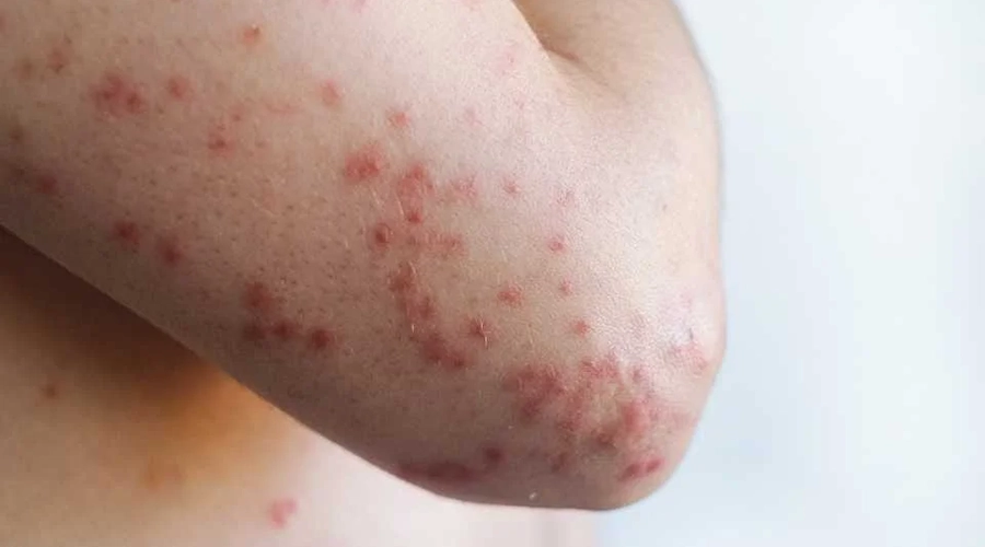 Plecas-e-informacion-2026-02-11T230905.454-1