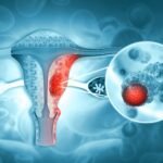 cancer-ovario-diagnostico-scaled
