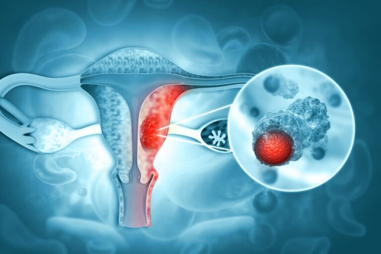 cancer-ovario-diagnostico-scaled